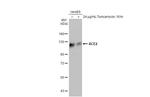 ACE2 Antibody in Western Blot (WB)