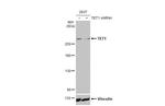 TET1 Antibody in Western Blot (WB)