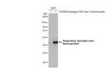 RSV NP Antibody in Western Blot (WB)