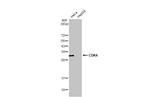 CDK4 Antibody in Western Blot (WB)