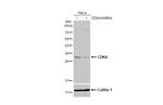 CDK4 Antibody in Western Blot (WB)