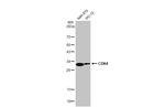 CDK4 Antibody in Western Blot (WB)