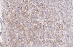 MC1R Antibody in Immunohistochemistry (Paraffin) (IHC (P))