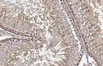 MC1R Antibody in Immunohistochemistry (Paraffin) (IHC (P))