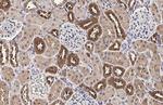 MC1R Antibody in Immunohistochemistry (Paraffin) (IHC (P))