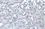 ROCK1/ROCK2 Antibody in Immunohistochemistry (Paraffin) (IHC (P))