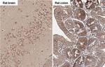 ROCK1/ROCK2 Antibody in Immunohistochemistry (Paraffin) (IHC (P))