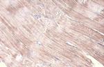 alpha Actinin 2 Antibody in Immunohistochemistry (Paraffin) (IHC (P))