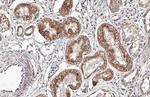 VEGF Antibody in Immunohistochemistry (Paraffin) (IHC (P))