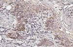 CYP24A1 Antibody in Immunohistochemistry (Paraffin) (IHC (P))