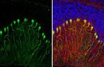 Calbindin/Calretinin Antibody in Immunohistochemistry (Paraffin) (IHC (P))