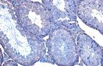 HSC70 Antibody in Immunohistochemistry (Paraffin) (IHC (P))