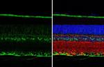 CRALBP Antibody in Immunohistochemistry (Paraffin) (IHC (P))