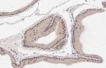 MAP2K4 Antibody in Immunohistochemistry (Paraffin) (IHC (P))