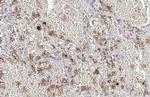 CD97 Antibody in Immunohistochemistry (Paraffin) (IHC (P))