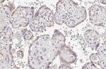 Ly-6E Antibody in Immunohistochemistry (Paraffin) (IHC (P))