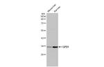 GPD1 Antibody in Western Blot (WB)