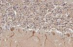 ISG15 Antibody in Immunohistochemistry (Paraffin) (IHC (P))