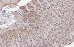 CDK6 Antibody in Immunohistochemistry (Paraffin) (IHC (P))