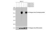 Dengue Virus Type 2/4 Envelope Antibody in Western Blot (WB)