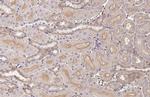 GNAI1/GNAI2/GNAI3 Antibody in Immunohistochemistry (Paraffin) (IHC (P))