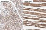 NDUFS3 Antibody in Immunohistochemistry (Paraffin) (IHC (P))