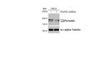 Periostin Antibody in Western Blot (WB)