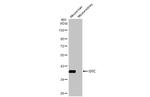 OTC Antibody in Western Blot (WB)