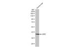 OTC Antibody in Western Blot (WB)