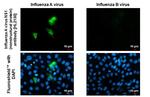 Influenza A H1N1 HA (A/California/07/2009) Antibody in Immunocytochemistry (ICC/IF)