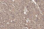 ADFP Antibody in Immunohistochemistry (Paraffin) (IHC (P))