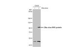 Zika Virus NS5 Antibody in Western Blot (WB)