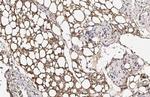 FASN Antibody in Immunohistochemistry (Paraffin) (IHC (P))