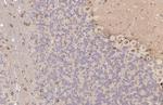 FASN Antibody in Immunohistochemistry (Paraffin) (IHC (P))