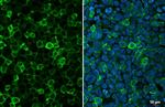 IBA1 Antibody in Immunocytochemistry (ICC/IF)