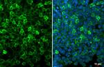 IBA1 Antibody in Immunocytochemistry (ICC/IF)