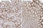 uPAR Antibody in Immunohistochemistry (Paraffin) (IHC (P))