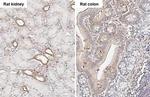 uPAR Antibody in Immunohistochemistry (Paraffin) (IHC (P))