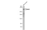 WNK1 Antibody in Western Blot (WB)