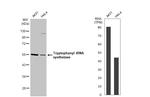 WARS Antibody in Western Blot (WB)