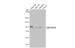 FOXO3A Antibody in Western Blot (WB)