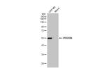 PFKFB4 Antibody in Western Blot (WB)