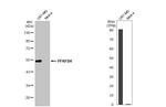 PFKFB4 Antibody in Western Blot (WB)