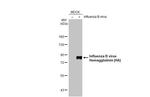 Influenza B virus (B/Taiwan/753/2005) (Yamagata) Antibody in Western Blot (WB)