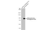 Influenza B virus (B/Taiwan/753/2005) (Yamagata) Antibody in Western Blot (WB)