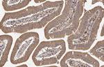 mTOR Antibody in Immunohistochemistry (Paraffin) (IHC (P))