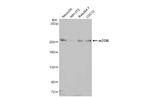 mTOR Antibody in Western Blot (WB)