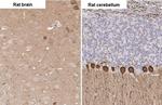 PKC gamma Antibody in Immunohistochemistry (Paraffin) (IHC (P))