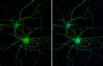 PKC gamma Antibody in Immunocytochemistry (ICC/IF)