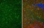 S100B Antibody in Immunohistochemistry (Paraffin) (IHC (P))